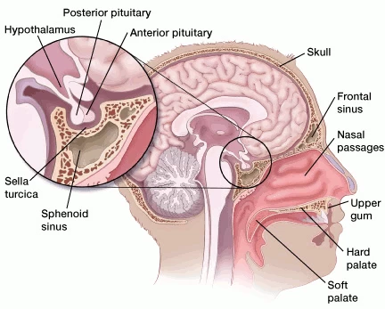 pituitary-tumour